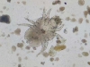 housedustmite